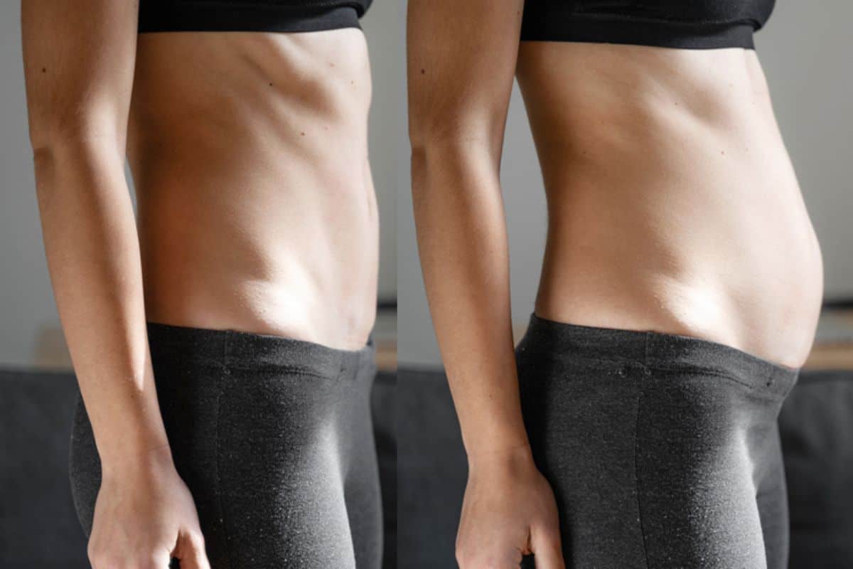 How long does diastasis recti take to improve Stowmarket?