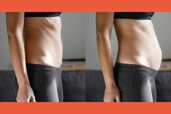 LA-EMS Body Sculpting results Stowmarket